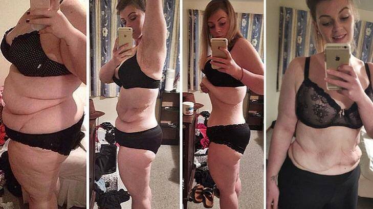 Elora Harre documented her 55 kilogram weight loss over two years.  Photo: Facebook