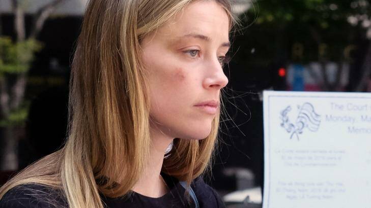 A bruised Amber Heard leaves court after accusing husband Johnny Depp of domestic abuse. Photo: Richard Vogel