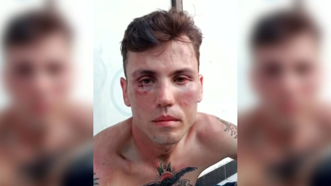 Matthew Stevenson is recovering from head and facial wounds after he was attacked outside a Kuta nightclub. Picture via Seven News