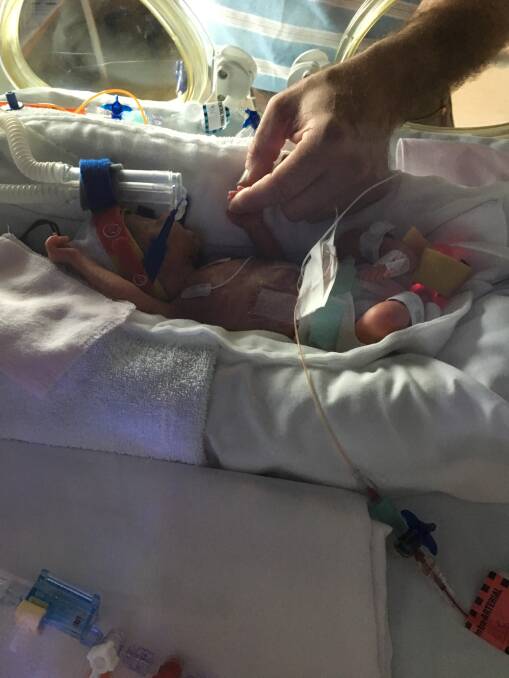 TINY TOUCH: Millie Page at four days old. She was born at 26 weeks with her parents grateful for the enduring support of Ronald McDonald House Charities. Picture: Supplied