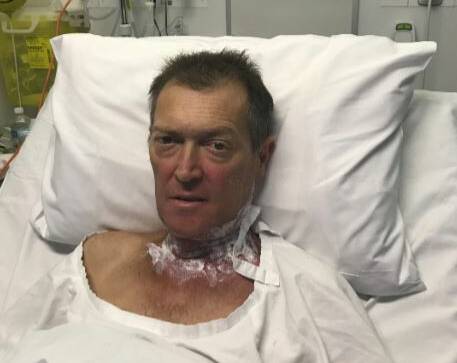 Mittagong's Scott Morton after being diagnosed and operated on for tonsil cancer. 